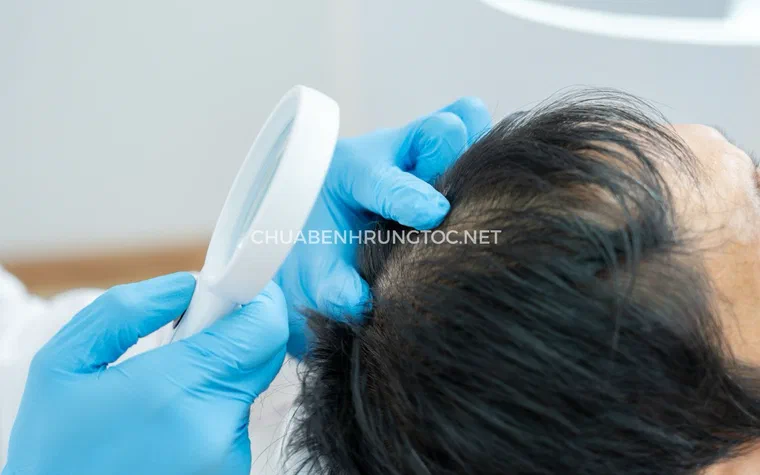 Bác sĩ đeo găng tay soi da đầu cho bệnh nhân bằng kính lúp chuyên dụng