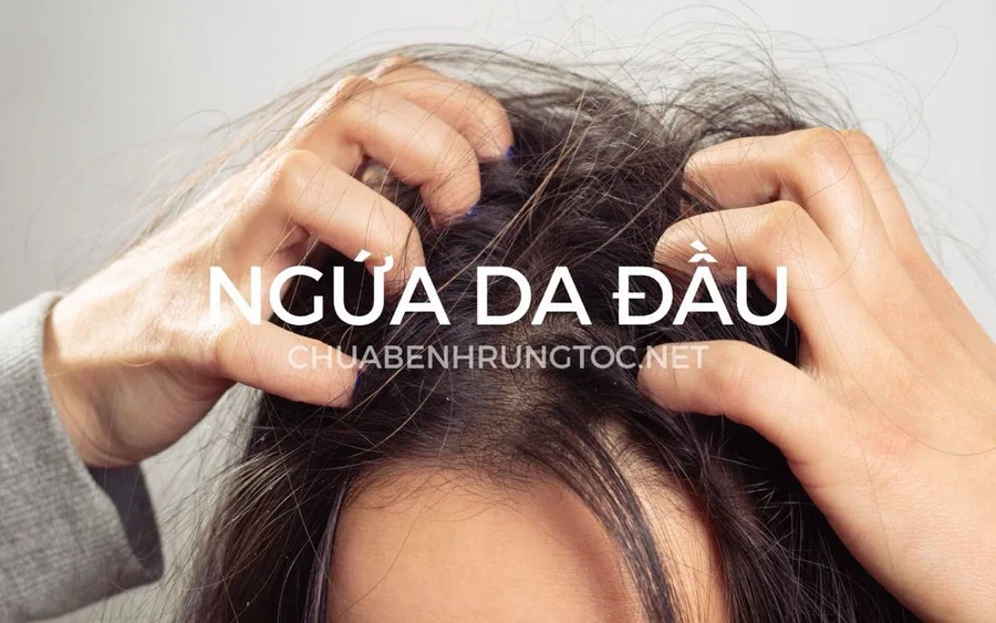 Hết ngứa da đầu chỉ sau 1 tháng khi thực hiện đúng cách